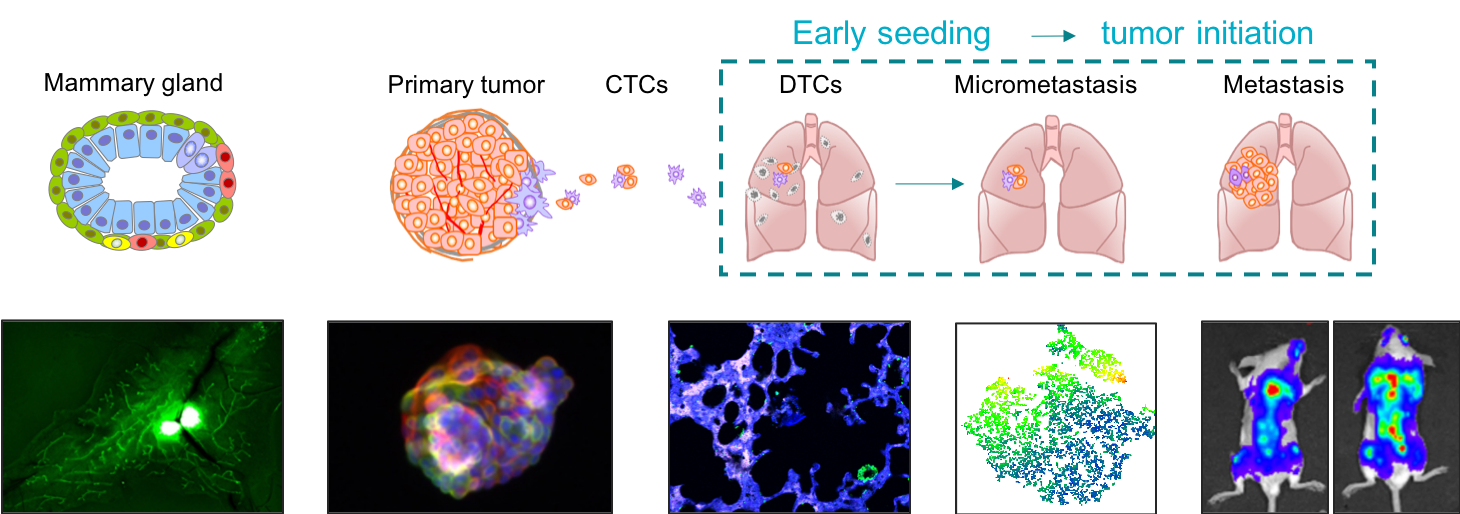 metastasis proces